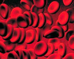 The accumulation of keton bodies in the blood in diabetes